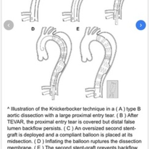 2020 NS Bikes Metropolis 2 Black